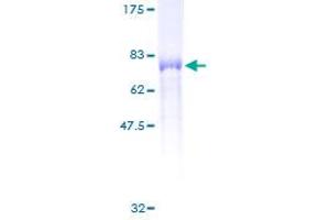 PSTPIP1 Protein (AA 1-416) (GST tag)