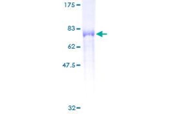 PSTPIP1 Protein (AA 1-416) (GST tag)