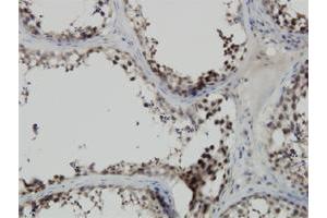 Immunohistochemistry (Formalin-fixed Paraffin-embedded Sections) (IHC (fp)) image for anti-PDZ Binding Kinase (PBK) (AA 1-110) antibody (ABIN527757)