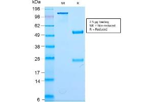 SDS-PAGE Analysis Purified Neurofilament Rabbit Monoclonal Antibody (NEFL/2983R). (Rekombinanter NEFL Antikörper)