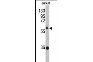 Western blot analysis of ZBTB2 antibody (C-term) (ABIN390710 and ABIN2840992) in Jurkat cell line lysates (35 μg/lane).