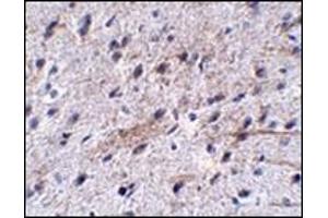 Immunohistochemistry (Paraffin-embedded Sections) (IHC (p)) image for anti-Leucine Rich Repeat and Fibronectin Type III Domain Containing 5 (LRFN5) (C-Term) antibody (ABIN500194)