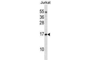 TCEB1 Antibody (C-term) western blot analysis in Jurkat cell line lysates (35 µg/lane). (TCEB1 Antikörper  (C-Term))