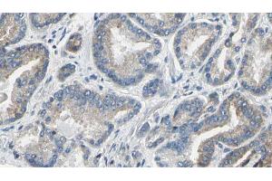 ABIN6274207 at 1/100 staining Human prostate tissue by IHC-P. (DTYMK Antikörper  (Internal Region))