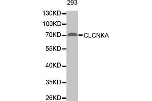 Western Blotting (WB) image for anti-Chloride Channel Ka (CLCNKA) antibody (ABIN1871886) (CLCNKA Antikörper)