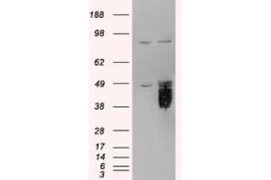 Image no. 2 for anti-Tissue Factor Pathway Inhibitor (Lipoprotein-Associated Coagulation Inhibitor) (TFPI) (C-Term) antibody (ABIN374077) (TFPI Antikörper  (C-Term))