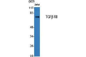 Western Blotting (WB) image for anti-Transforming Growth Factor, beta Receptor II (70/80kDa) (TGFBR2) (Internal Region) antibody (ABIN3187248) (TGFBR2 Antikörper  (Internal Region))
