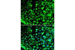 Immunofluorescence analysis of HeLa cells using CALU antibody. (CALU Antikörper)