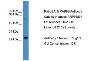 WB Suggested Anti-RAB9B  Antibody Titration: 0. (RAB9B Antikörper  (N-Term))