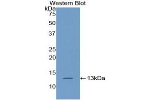 Detection of Recombinant PABPC1L, Human using Polyclonal Antibody to Poly A Binding Protein Cytoplasmic 1 Like Protein (PABPC1L) (PABPC1L Antikörper  (AA 514-612))