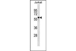 Western blot analysis of ENOX2 Antibody (N-term) in Jurkat cell line lysates (35ug/lane). (ENOX2 Antikörper  (N-Term))
