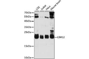 Western blot analysis of extracts of various cell lines, using LSM12 antibody (ABIN7268307) at 1000 dilution. (LSM12B Antikörper  (AA 1-195))