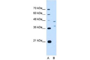 EVI2B antibody used at 2.