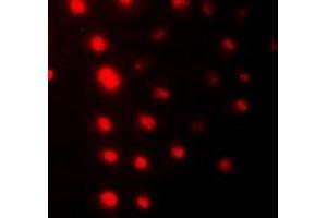 Immunofluorescent analysis of ZNF7 staining in HeLa cells. (ZNF7 Antikörper  (N-Term))