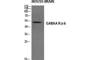 Western Blot (WB) analysis of specific cells using GABAA Ralpha6 Polyclonal Antibody. (GABRA6 Antikörper  (Internal Region))