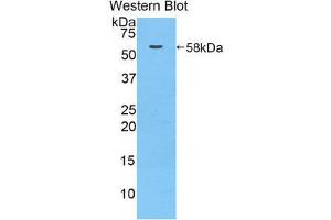 Western Blotting (WB) image for anti-Metastasis Associated in Colon Cancer 1 (MACC1) (AA 522-784) antibody (ABIN1859735) (MACC1 Antikörper  (AA 522-784))