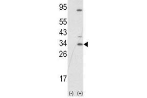 Western blot analysis of SNAI1 antibody and 293 cell lysate (2 ug/lane) either nontransfected (Lane 1) or transiently transfected with the SNAIL gene (2). (SNAIL Antikörper  (AA 1-30))