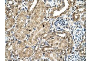 Immunohistochemistry (IHC) image for anti-T-Box 15 (TBX15) (C-Term) antibody (ABIN310938) (T-Box 15 Antikörper  (C-Term))