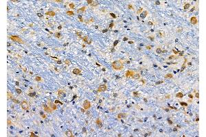 ABIN6257466 and ABIN6274772 at 1/100 staining Rat brain tissue by IHC-P. (RPL19 Antikörper  (C-Term))