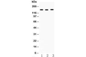Western blot testing of ACE antibody and (1) HeLa, (2) A549 and (3) 22RV1 lysate. (Angiotensin I Converting Enzyme 1 Antikörper  (Middle Region))