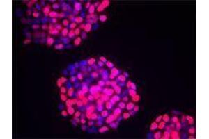 Immunofluorescence (IF) image for anti-Tumor Protein P53 (TP53) antibody (ABIN2664006)