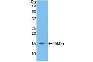 Detection of Recombinant NKB, Human using Polyclonal Antibody to Neurokinin B (NKB) (Tachykinin 3 Antikörper  (AA 23-121))