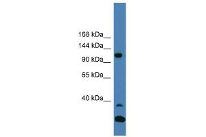 WB Suggested Anti-TYK2 Antibody Titration:  0. (TYK2 Antikörper  (C-Term))