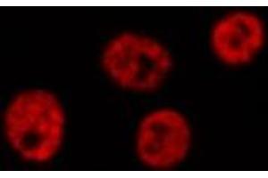 ABIN6276851 staining HepG2? (LIG4 Antikörper  (C-Term))