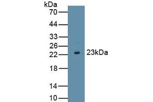 Detection of Recombinant IFNt, Bovine using Polyclonal Antibody to Interferon Tau (IFNt) (Interferon Tau Antikörper  (AA 24-195))