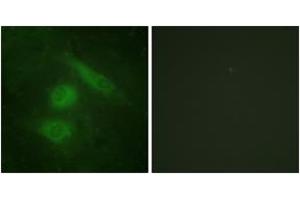 Immunofluorescence analysis of HeLa cells, using IRF3 (Ab-385) Antibody. (IRF3 Antikörper  (AA 351-400))