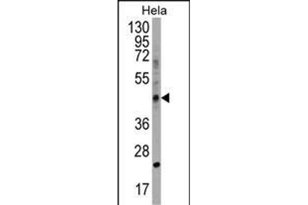 CHID1 Antikörper  (C-Term)