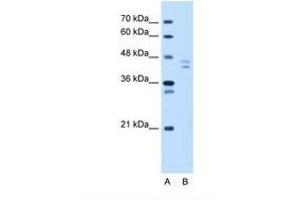 Image no. 1 for anti-Proteasome (Prosome, Macropain) 26S Subunit, Non-ATPase, 11 (PSMD11) (N-Term) antibody (ABIN324265) (PSMD11 Antikörper  (N-Term))