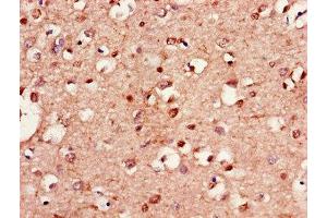 Immunohistochemistry of paraffin-embedded human brain tissue using ABIN7157902 at dilution of 1:100