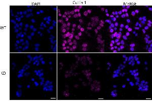 Immunocytochemical staining of 293T cells using Cullin 1 antibody (ABIN7798176), 1:1,000), Top panel: wild-type (WT), Bottom panal: Cullin 1 shRNA knockdown (KD). (Rekombinanter Cullin 1 Antikörper)