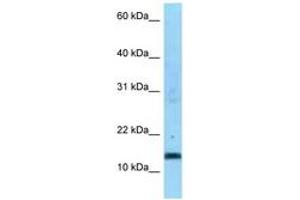 Image no. 1 for anti-Succinate Dehydrogenase Complex, Subunit C, Integral Membrane Protein, 15kDa (SDHC) (AA 59-108) antibody (ABIN6748189) (SDHC Antikörper  (AA 59-108))