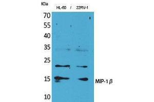 Western Blotting (WB) image for anti-Chemokine (C-C Motif) Ligand 4 (CCL4) (Internal Region) antibody (ABIN3187742)