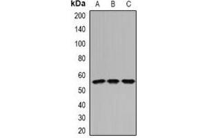 Western blot analysis of IFI44 expression in Hela (A), mouse kidney (B), rat kidney (C) whole cell lysates. (IFI44 Antikörper)