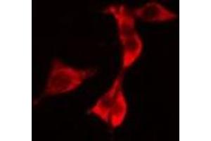 ABIN6277226 staining 293 cells by IF/ICC. (RIPK2 Antikörper  (N-Term))