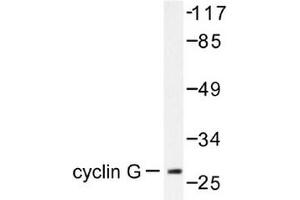 Image no. 1 for anti-Cyclin G1 (CCNG1) antibody (ABIN265382) (Cyclin G1 Antikörper)