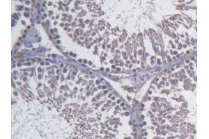 Detection of FBLN1 in Rat Testis Tissue using Monoclonal Antibody to Fibulin 1 (FBLN1) (Fibulin 1 Antikörper)