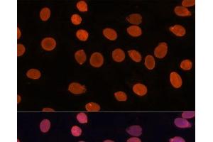 Immunofluorescence analysis of C6 cells using TADA3 Polyclonal Antibody at dilution of 1:100. (TADA3L Antikörper)
