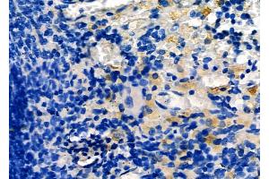 ABIN6265630 and ABIN6266708 at 1/100 staining Rat spleen tissue by IHC-P.