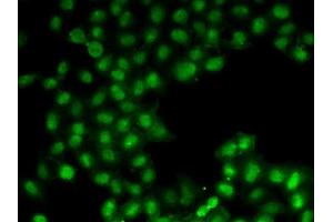 Immunofluorescence analysis of U2OS cells using C11orf30 antibody (ABIN6127846, ABIN6137723, ABIN6137725 and ABIN6221740).