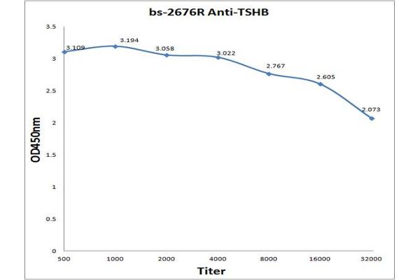 TSH Antikörper  (AA 51-138)