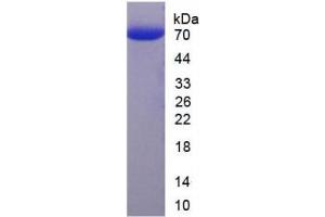 Image no. 1 for Hyaluronan Binding Protein 2 (HABP2) (AA 24-560) protein (His tag) (ABIN4989318) (HABP2 Protein (AA 24-560) (His tag))