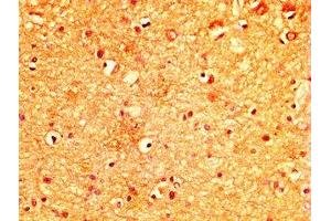 IHC image of ABIN7174953 diluted at 1:300 and staining in paraffin-embedded human brain tissue performed on a Leica BondTM system. (MYO5A Antikörper  (AA 1087-1220))