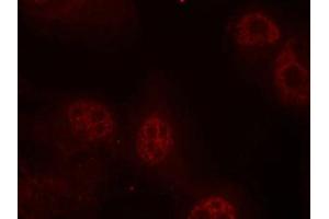 Immunofluorescence staining of methanol-fixed Hela cells using Myc(Phospho-Ser62) Antibody. (c-MYC Antikörper  (pSer62))