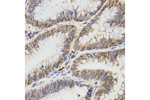 Immunohistochemistry (IHC) image for anti-Tropomyosin-2 (TPM2) antibody (ABIN3017365)
