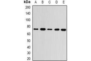 Western blot analysis of GMPS expression in MCF7 (A), SKOV3 (B), mouse kidney (C), mouse brain (D), rat heart (E) whole cell lysates. (GMP Synthase Antikörper)