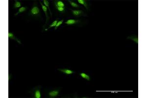 Immunofluorescence of purified MaxPab antibody to DNAJB4 on HeLa cell. (DNAJB4 Antikörper  (AA 1-337))